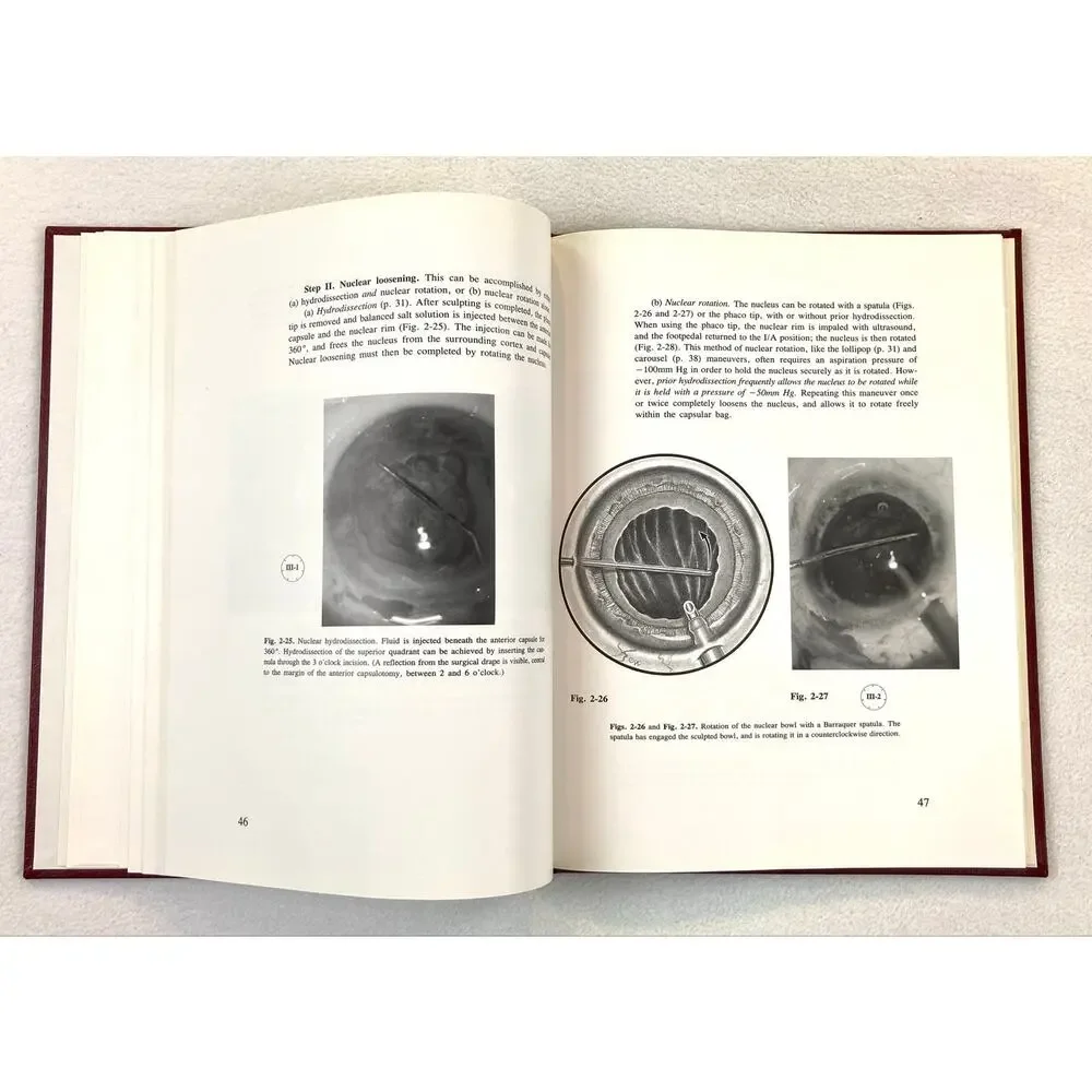 The Stereoatlas of Phacoemulsification and IOL Implantion Vintage 1990